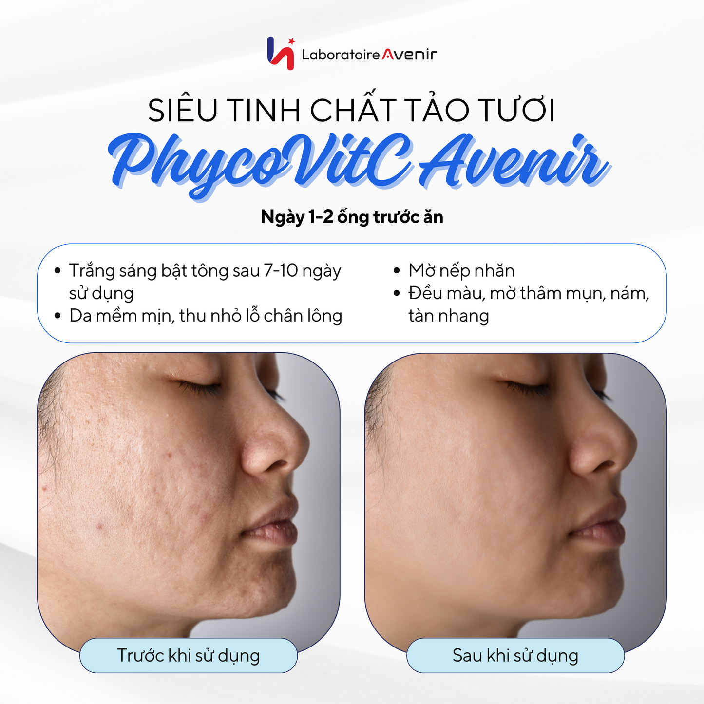 PhycovitC - Siêu Tinh Chất Tảo Pháp Thế Hệ Mới