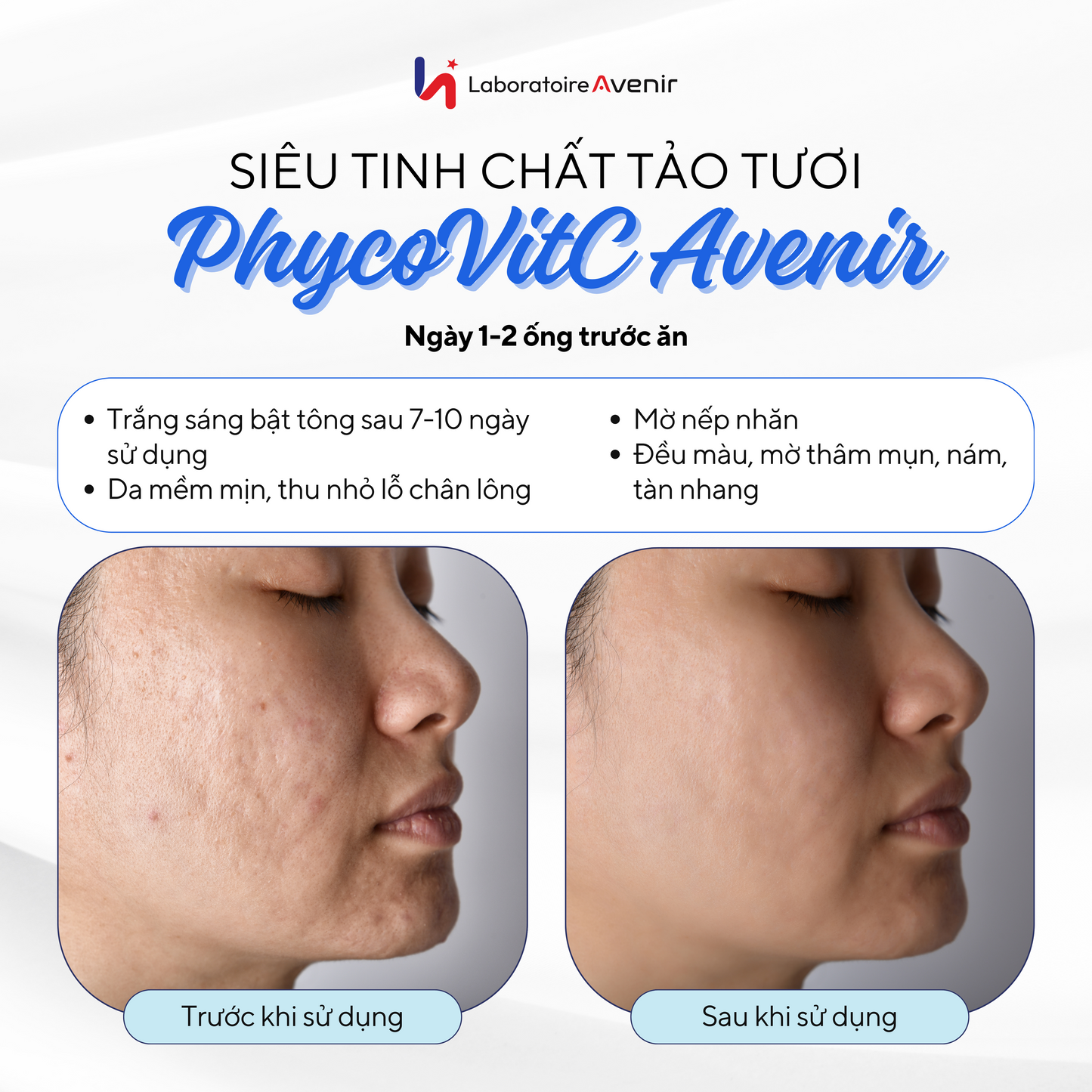 Siêu Tinh Chất Tảo Pháp PhycovitC