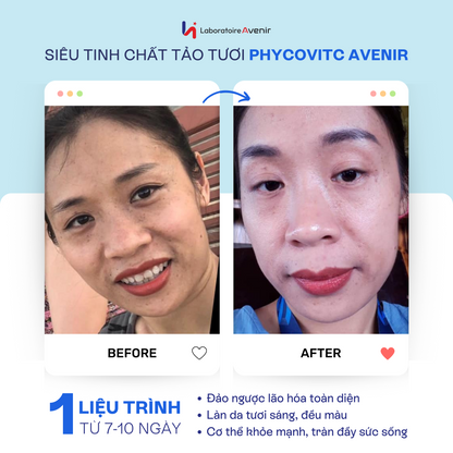 Siêu Tinh Chất Tảo Pháp PhycovitC